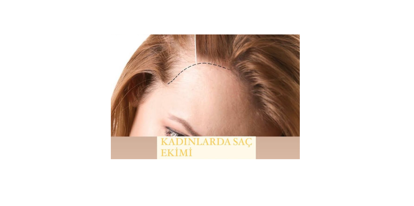 Seda Şentürk Hair Transplant&Esthetic